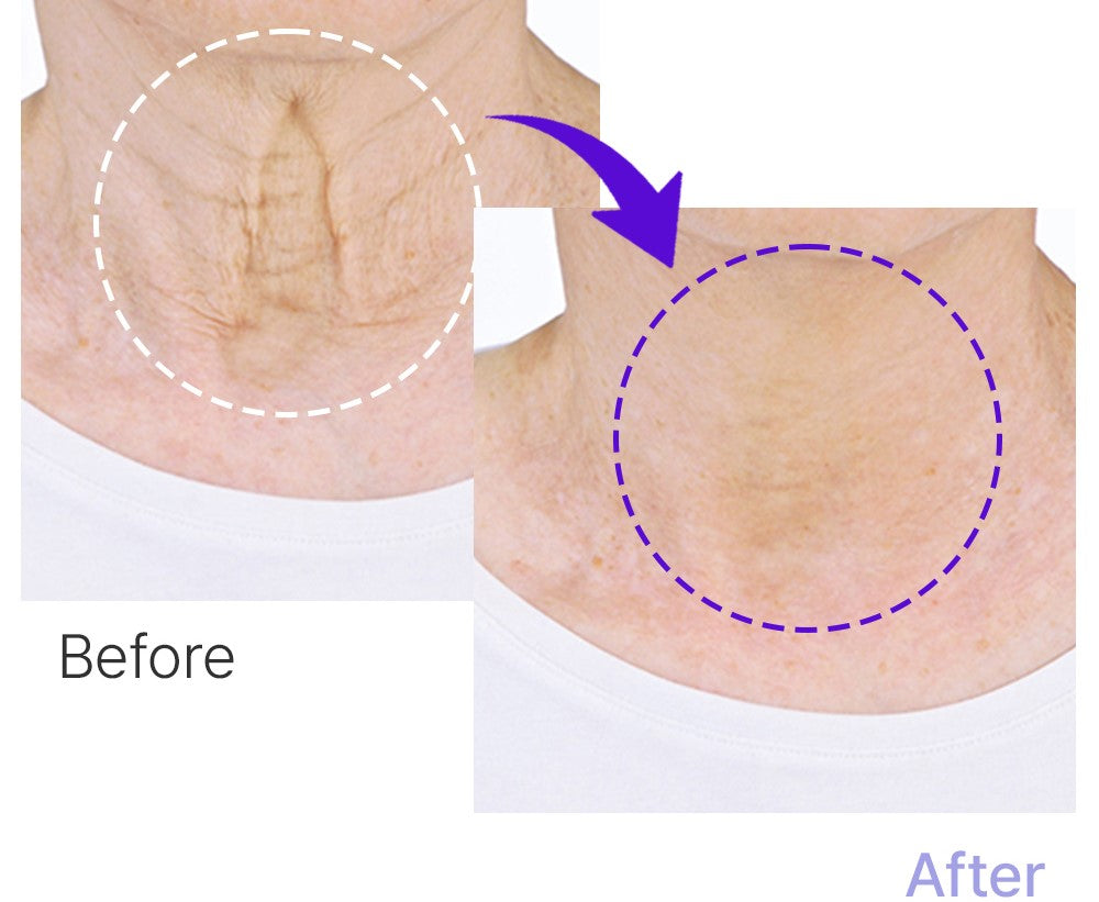 Advanced Line Lift Serum