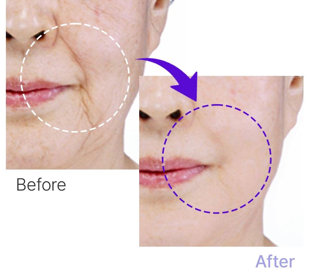 Advanced Line Lift Serum